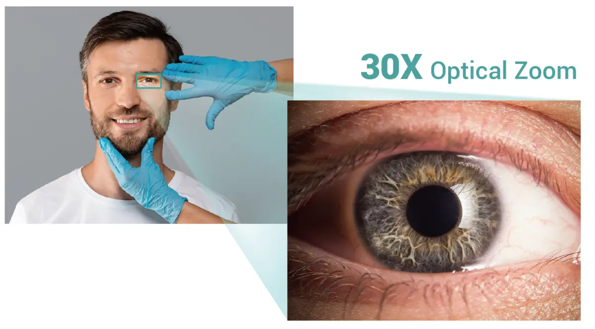 Caméra Zoom Optique x30 - AVer MD330U